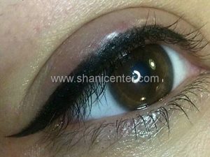 میکروپیگمنتیشن چشم