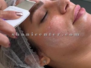 پاکسازی پوست صورت فشیال
