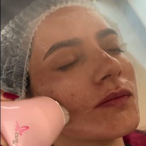 فشیال پاکسازی پوست (1)