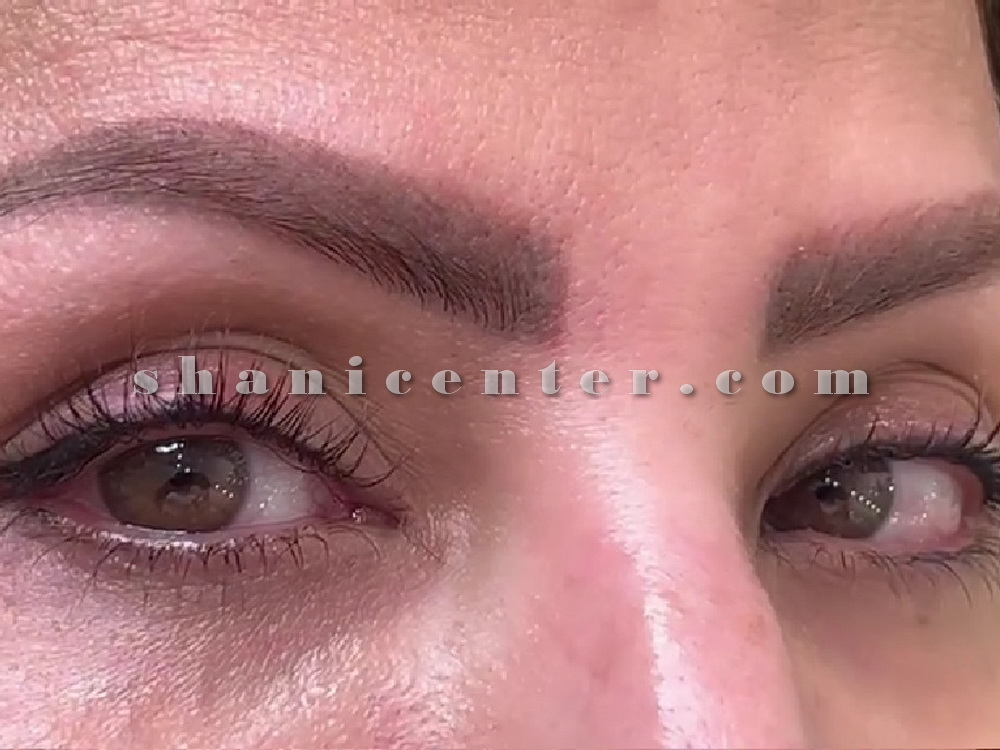 اجرای بن مژه