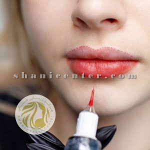 تاتو ترمیم لب