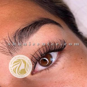 ترمیم مژه کلاسیک