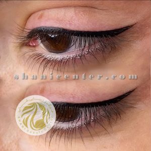 ترمیم تاتو خط چشم بالا