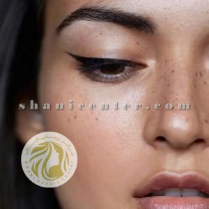 ترمیم تاتو خط چشم بالا و پایین