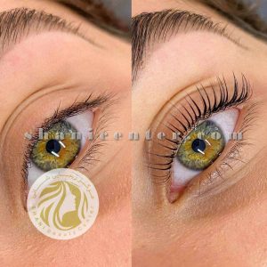 لیفت مژه و ابرو