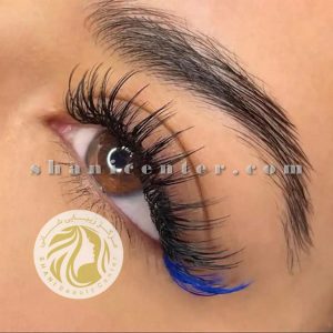 کاشت مژه اسپایکی