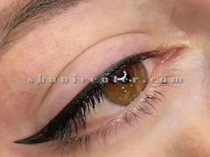 میکروبلیدینگ خط چشم 3