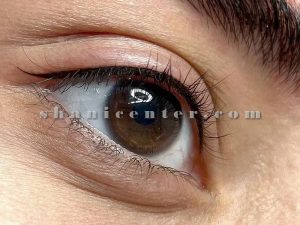 میکروبلیدینگ خط چشم 4
