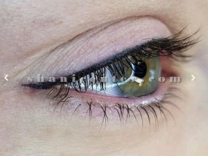 میکروبلیدینگ خط چشم 6
