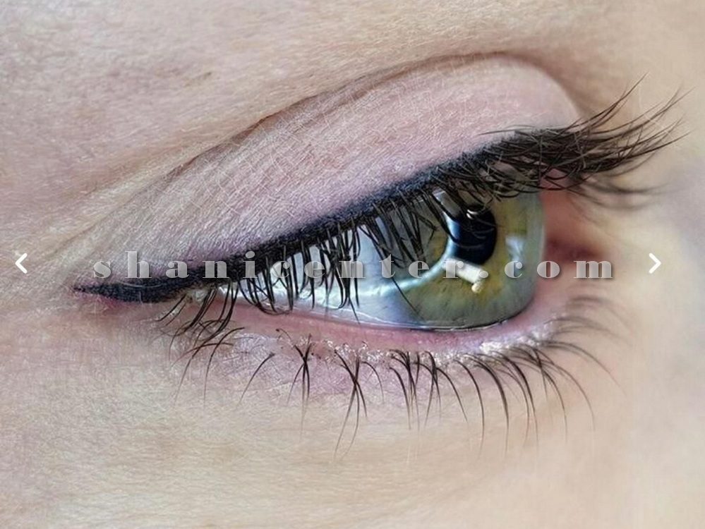 میکروبلیدینگ خط چشم